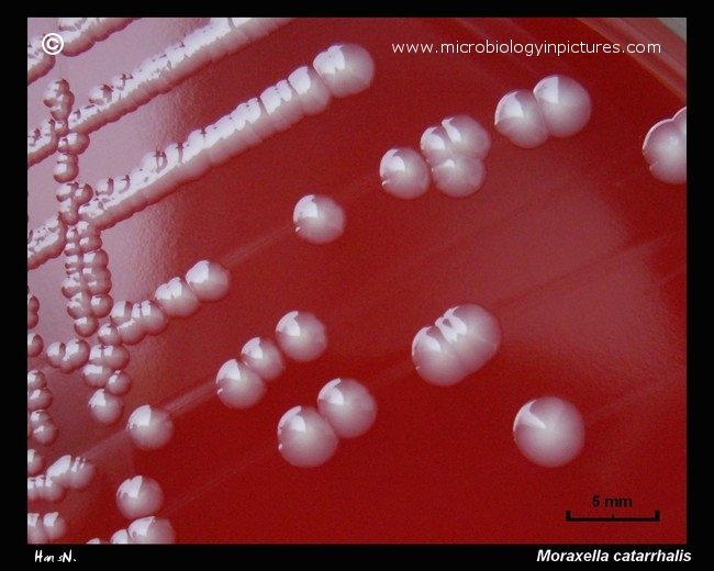 moraxella catarrhalis colony morphology on blood agar